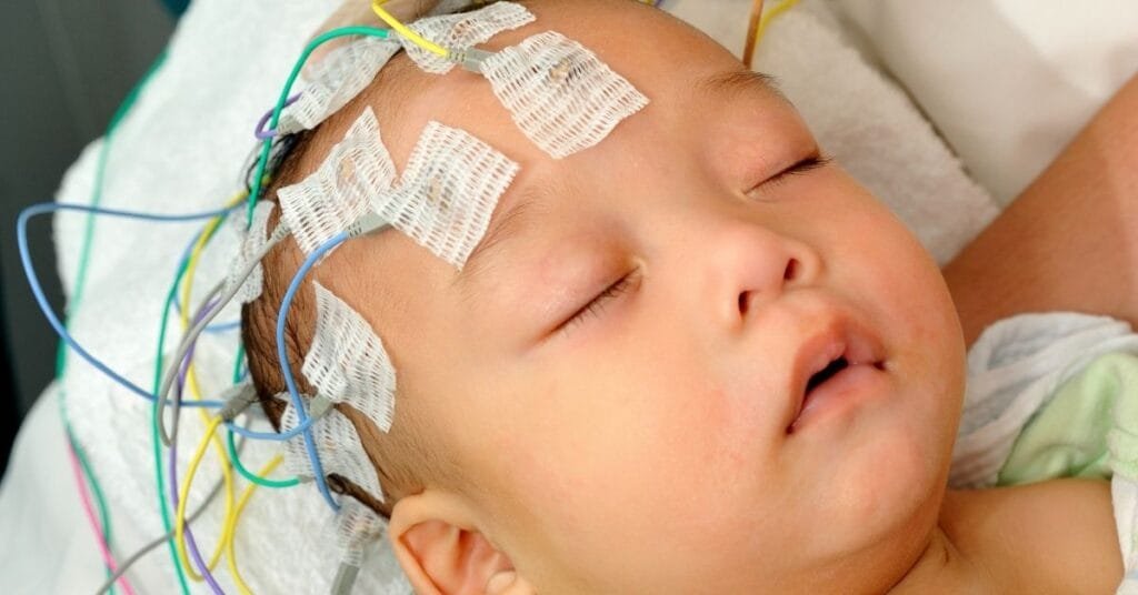 Convulsiones en Bebés: Cómo Actuar